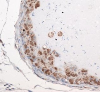 Immunohistochemistry: Exosome Component 9 Antibody - Staining of EXOSC9 in mouse prostate.