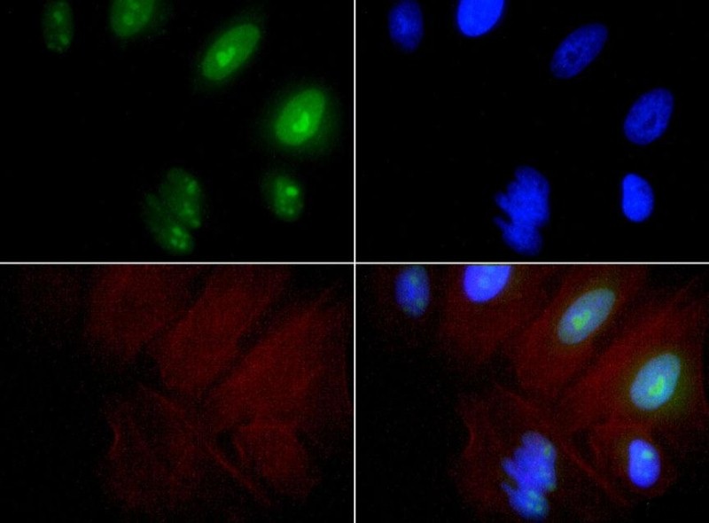 Immunocytochemistry/Immunofluorescence: Exosome Component 9 Antibody - EXOSC9 antibody was tested at 1:100 in HeLa cells with FITC (green). Nuclei and actin were counterstained with Dapi (blue) and Phalloidin (red).