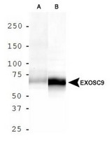 Western Blot: Exosome Component 9 Antibody - Analysis of EXOSC9 in A. HepG2 cell lysate and B. MCF7 cell lysate.
