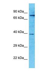 Western blot of EXT2 Antibody with human Placenta lysate.