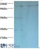 Western blot of Exostosin-like 3 antibody at 2 ug/ml. Lane 1: EC109 whole cell lysate. Lane 2: 293T whole cell lysate. Secondary: Goat polyclonal to Rabbit IgG at 1:15000 dilution. Predicted band size: 101 kDa. Observed band size: 101 kDa Additional bands at: 50 kDa. ã€34 kDa. We are unsure as to the identity of this extra bands.