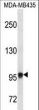 EXTL3 Antibody western blot of MDA-MB435 cell line lysates (35 ug/lane). The EXTL3 antibody detected the EXTL3 protein (arrow).