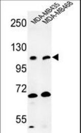 Western blot of EXTL3 Antibody in MDA-MB435, MDA-MB468 cell line lysates (35 ug/lane). EXTL3 (arrow) was detected using the purified antibody.
