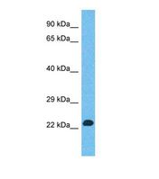 Western blot of Human Thyroid tumor. EYA1 antibody dilution 1.0 ug/ml.