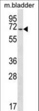 EYA1 Antibody western blot of mouse bladder tissue lysates (35 ug/lane). The EYA1 antibody detected the EYA1 protein (arrow).