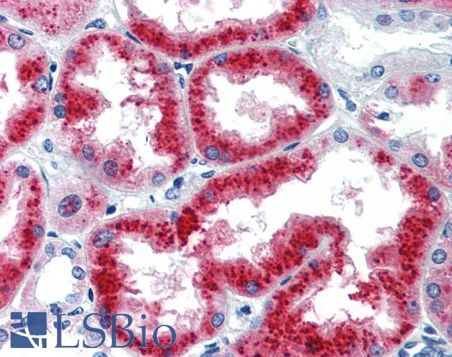 Anti-EYA1 antibody IHC of human kidney. Immunohistochemistry of formalin-fixed, paraffin-embedded tissue after heat-induced antigen retrieval. Antibody LS-B3491 concentration 5 ug/ml.