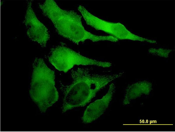 Immunofluorescence of monoclonal antibody to EYA2 on HeLa cell. [antibody concentration 10 ug/ml]