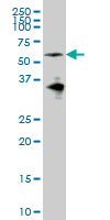 EYA2 monoclonal antibody (M04), clone 2F8 Western Blot analysis of EYA2 expression in IMR-32.