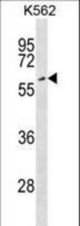 EYA2 Antibody western blot of K562 cell line lysates (35 ug/lane). The EYA2 antibody detected the EYA2 protein (arrow).