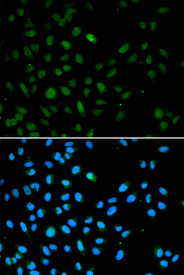 Immunofluorescence analysis of A549 cell using EZH1 antibody. Blue: DAPI for nuclear staining.