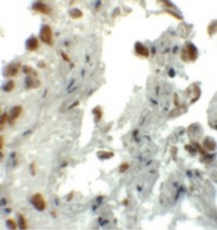 Immunohistochemistry of EZH1 in human lung tissue with EZH1 antibody at 5 ug/ml.