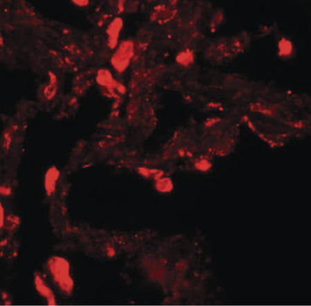 Immunofluorescence of EZH1 in human lung tissue with EZH1 antibody at 20 ug/ml.