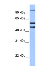 EZH1 antibody LS-C109883 Western blot of Fetal Brain lysate.