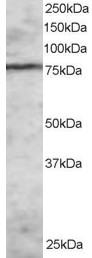 Antibody staining (2 ug/ml) of MOLT-4 lysate (RIPA buffer, 30 ug total protein per lane). Primary incubated for 1 hour. Detected by Western blot of chemiluminescence.