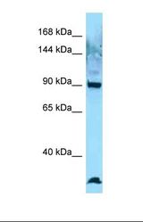 Western blot of Human Jurkat. EZR-ROS1 antibody dilution 1.0 ug/ml.