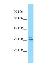 Eid2 antibody LS-C146422 Western blot of Mouse Kidney lysate. Antibody concentration 1 ug/ml.