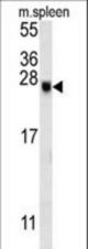 EID2 Antibody western blot of mouse spleen tissue lysates (15 ug/lane). The EID2 antibody detected EID2 protein (arrow).