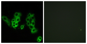 Immunofluorescence of MCF7 cells, using Encephalopsin Antibody. The picture on the right is treated with the synthesized peptide.