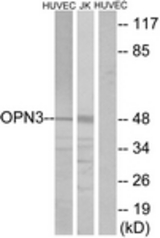 Western blot of extracts from HUVEC/Jurkat cells, using OPN3 Antibody. The lane on the right is treated with the synthesized peptide.