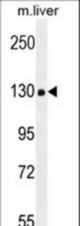 COL18A1 Antibody western blot of mouse liver tissue lysates (35 ug/lane). The COL18A1 antibody detected the COL18A1 protein (arrow).