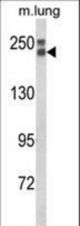 Western blot of COL18A1 Antibody in mouse lung tissue lysates (35 ug/lane). COL18A1 (arrow) was detected using the purified antibody.