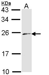 Sample (30 ug of whole cell lysate). A: Raji. 12% SDS PAGE. Endothelin 3 / EDN3 antibody diluted at 1:1000.
