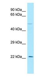 Endothelin 3 / EDN3 antibody Western Blot of PANC1.