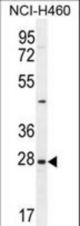 EDN3 Antibody western blot of NCI-H460 cell line lysates (35 ug/lane). The EDN3 antibody detected the EDN3 protein (arrow).