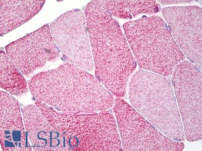 Anti-EOMES antibody IHC of human skeletal muscle. Immunohistochemistry of formalin-fixed, paraffin-embedded tissue after heat-induced antigen retrieval. Antibody LS-B6801 concentration 10 ug/ml.