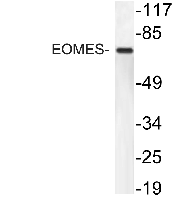 Western blot of EOMES antibody in extracts from HT29 cells.