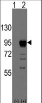 Western blot of EOMES (arrow) using rabbit polyclonal EOMES Antibody (Human N-term) (RB10349). 293 cell lysates (2 ug/lane) either nontransfected (Lane 1) or transiently transfected with the EOMES gene (Lane 2) (Origene Technologies).
