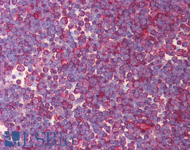 Anti-EOMES antibody IHC of human thymus. Immunohistochemistry of formalin-fixed, paraffin-embedded tissue after heat-induced antigen retrieval. Antibody LS-B1533 concentration 5 ug/ml.