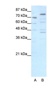 EOMES antibody LS-B1533 Western blot of HepG2 cell lysate.