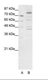 A: Marker, B: HepG2 Cell Lysate