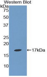 Western blot of recombinant Epsin 1 / EPN1.