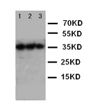 WB of Erythropoietin / EPO antibody. Lane 1: Recombinant human EPO Protein 10ng . Lane 2: Recombinant human EPO Protein 5ng . Lane 3: Recombinant human EPO Protein 2.5ng..
