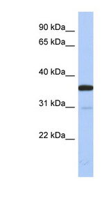 ESD antibody LS-C112224 Western blot of Fetal Kidney lysate.