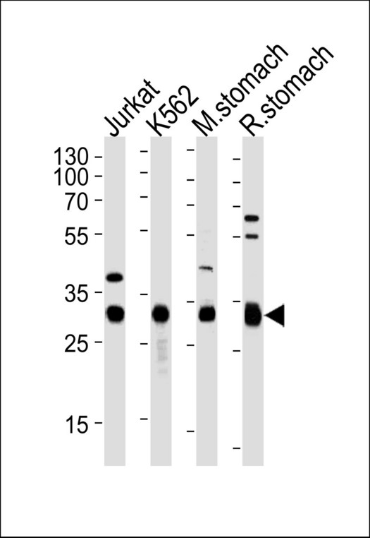 Western blot of lysates from Jurkat, K562 cell line, mouse stomach and rat stomach tissue (from left to right) with ESD Antibody. Antibody was diluted at 1:1000 at each lane. A goat anti-rabbit (HRP) at 1:5000 dilution was used as the secondary antibody. Lysates at 35 ug per lane.