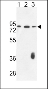 F12 Antibody western blot of K562(lane 1),CEM(lane 2),MDA-MB435(lane 3) cell line lysates (35 ug/lane). The F12 antibody detected the F12 protein (arrow).