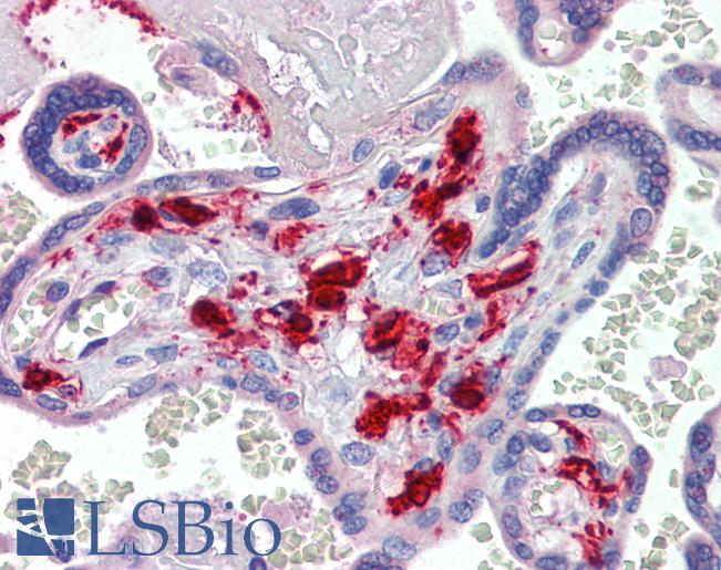 Anti-F13A1 / Factor XIIIa antibody IHC of human placenta. Immunohistochemistry of formalin-fixed, paraffin-embedded tissue after heat-induced antigen retrieval. Antibody LS-B3711 concentration 3 ug/ml.
