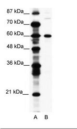 A: Marker, B: Jurkat Cell Lysate