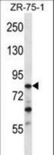 CNOT3 Antibody western blot of ZR-75-1 cell line lysates (35 ug/lane). The CNOT3 antibody detected the CNOT3 protein (arrow).