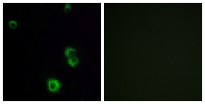 Immunofluorescence of MCF7 cells, using F2RL2 Antibody. The picture on the right is treated with the synthesized peptide.