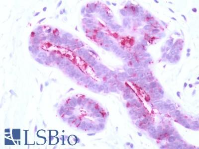 Human Breast: Formalin-Fixed, Paraffin-Embedded (FFPE)