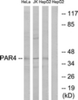 Western blot of extracts from HepG2/Jurkat/HeLa cells, using PAR4 Antibody. The lane on the right is treated with the synthesized peptide.