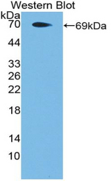 Western blot of recombinant F2RL3 / PAR4.
