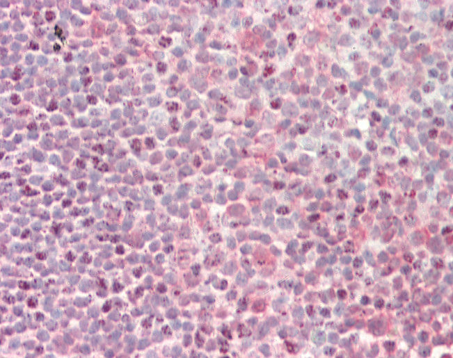 Human Tonsil: Formalin-Fixed, Paraffin-Embedded (FFPE)