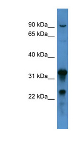 F8 / Factor VIII antibody LS-C135701 Western blot of 721_B cell lysate.