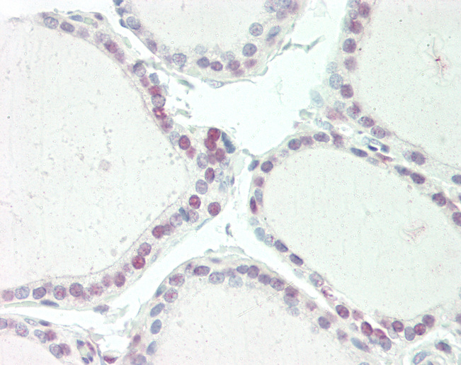 Human Thyroid: Formalin-Fixed, Paraffin-Embedded (FFPE)