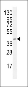 F8A2 Antibody western blot of CEM cell line lysates (35 ug/lane). The F8A2 antibody detected the F8A2 protein (arrow).